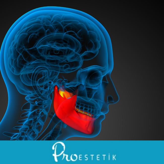 Masater Kasları Nedir? Çene Sağlığında Rolü ve Önemi
