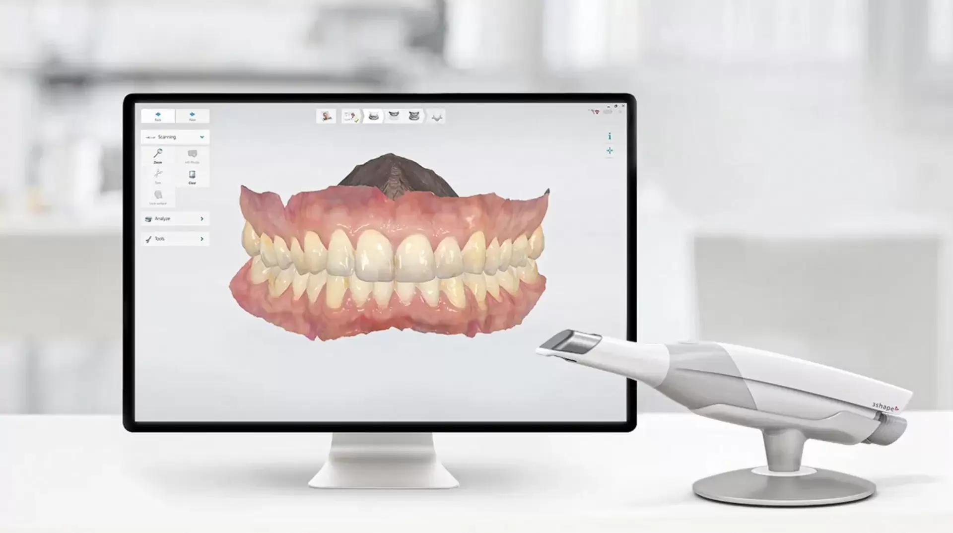 Dijital Gülüş Tasarımı (CAD/CAM) ile Yüzünüze En Uygun Diş Formu Nasıl Bulunur?