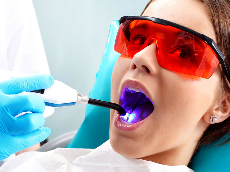 Lazer Destekli Dolgu Uygulamaları: Daha Güçlü Bağlanma ve Uzun Ömür