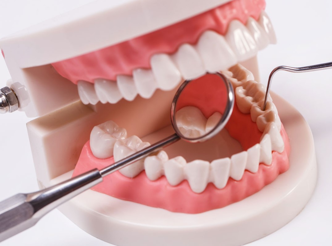 الأسنان الاصطناعية