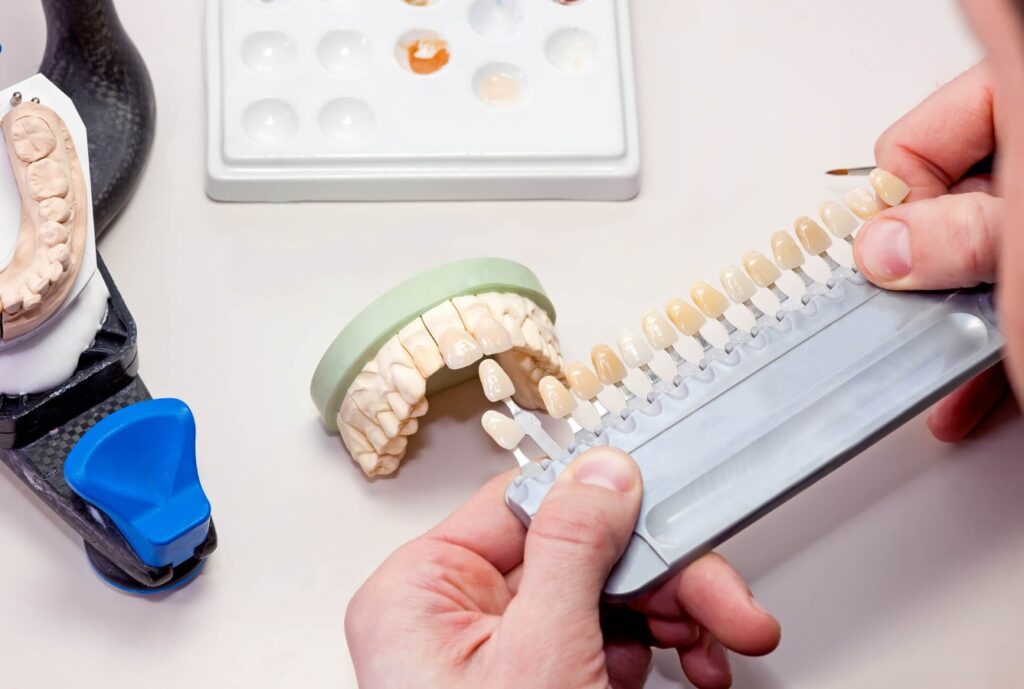 restoratif diş tedavisi yöntemleri