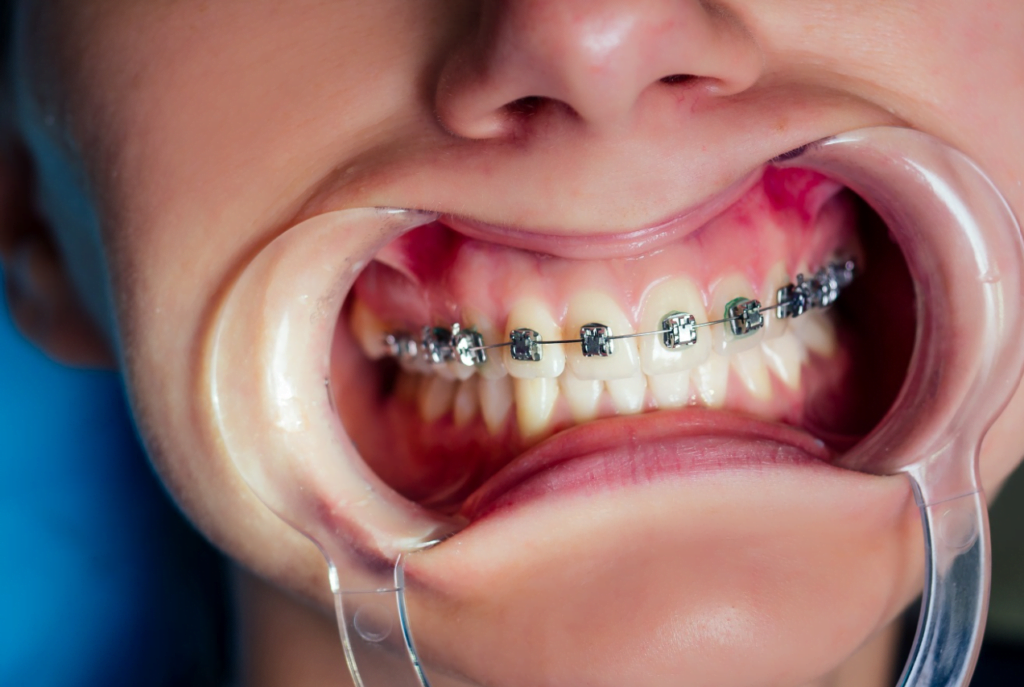 ortodonti ne demek