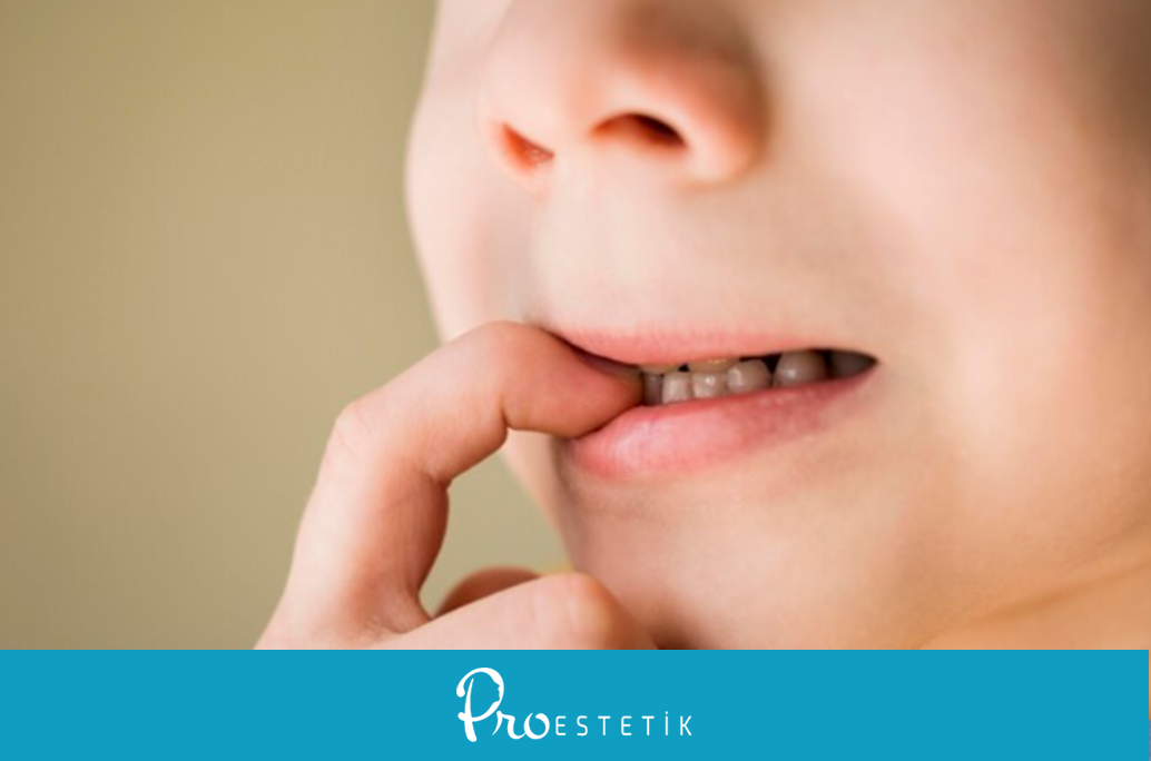 أسباب وعلاج طحن الأسنان عند الأطفال
