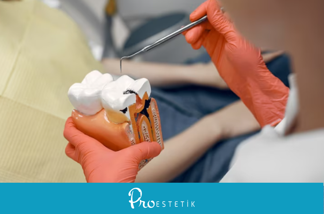 How Long Does Root Canal Treatment Take? Does It Cause Pain?