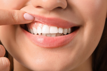 Diş Eti Kanseri Hakkında Bilmeniz Gereken 6 Şey