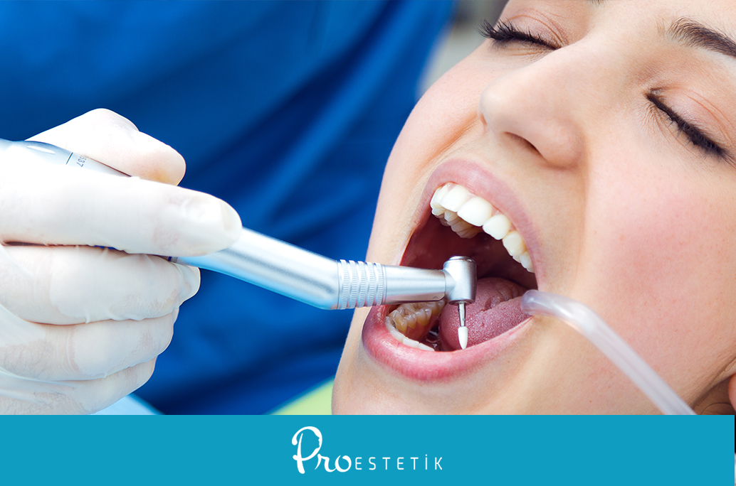 Zahnfleischbehandlung: 6 wichtige Behandlungen!