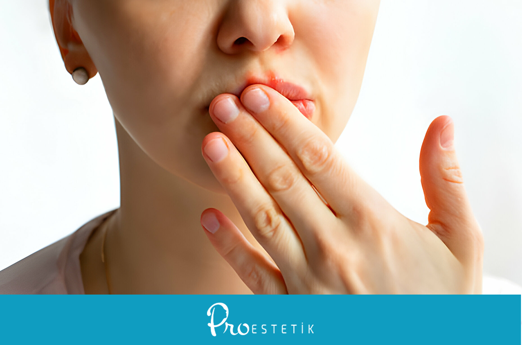 Was verursacht Lippenanschwellen? Wie wird es behandelt?