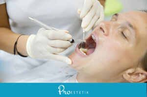 Periodontoloji Nedir?